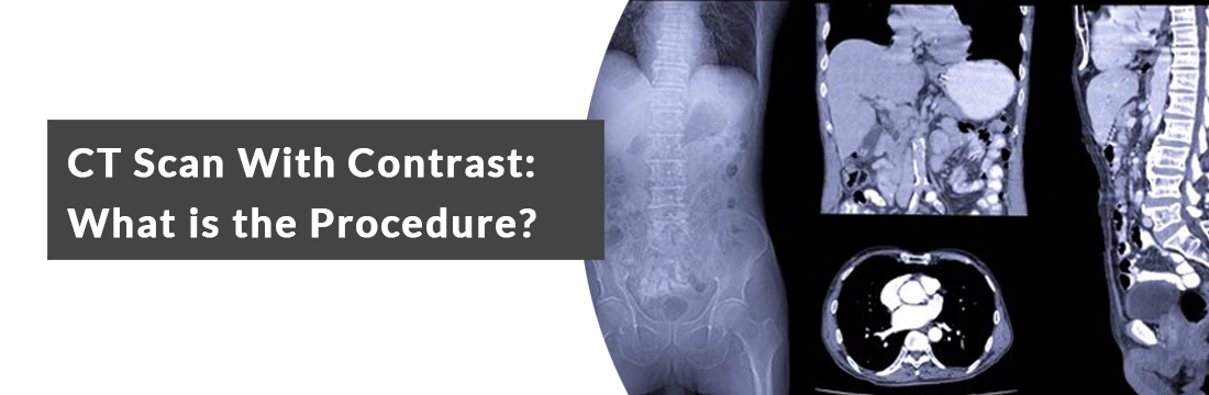 CT Scan With Contrast: What is the Procedure?